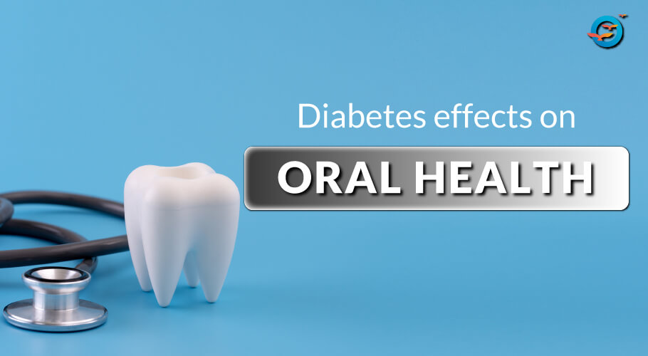 diabetes and oral health, the relationship between oral health and diabetes mellitus, diabetes and oral health an overview, diabetes and oral health articles, diabetes and oral health problems, diabetes mellitus and oral health