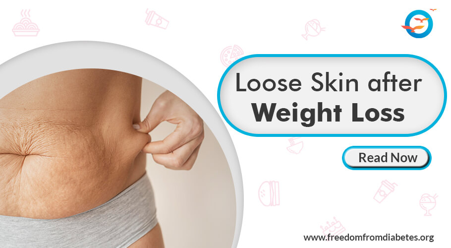Is it Possible to Tighten Loose Skin After Weight Loss Without