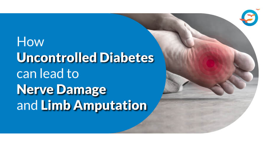 How uncontrolled diabetes can lead to nerve damage and limb amputation