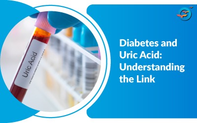 Diabetes & Uric Acid