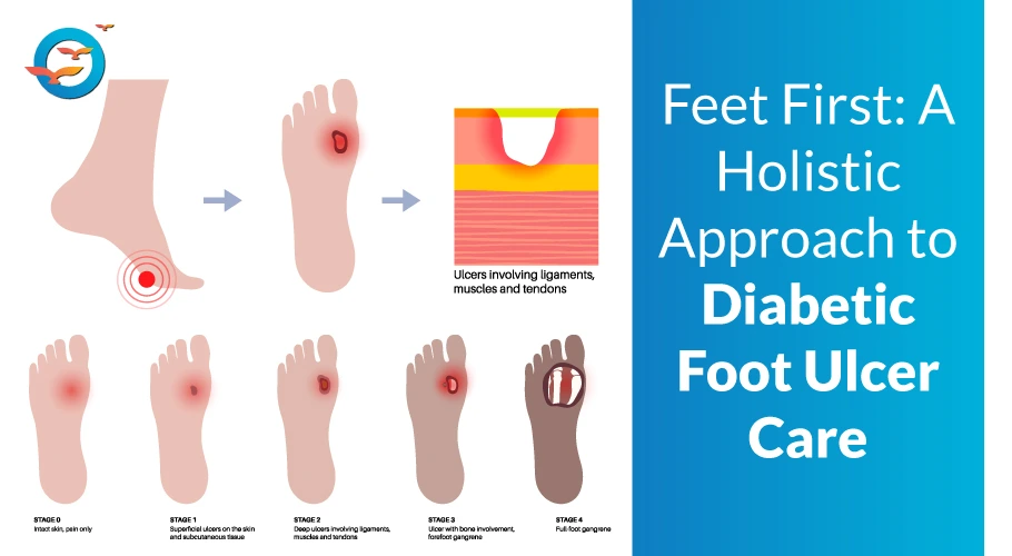 Best treatment for diabetic foot ulcer